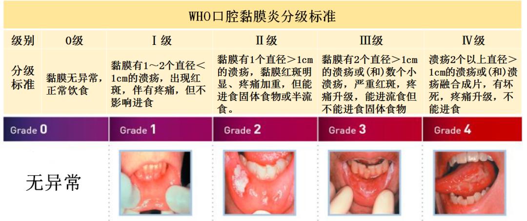 口腔溃疡疼痛难忍怎么缓解,口腔溃疡严重了怎么最快缓解疼痛