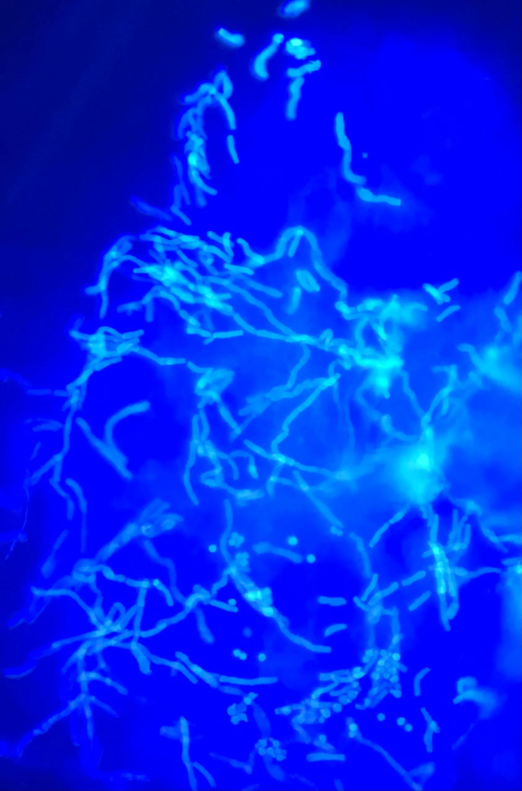 香港脚气脚癣怎么治,脚气怎么治专家现场演示