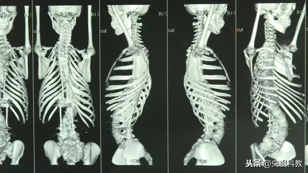 北京儿童医院西院骨科专家,北京儿童医院儿科骨科专家都有谁