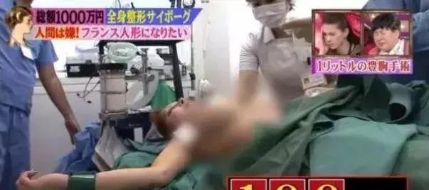 日本妹子花1286万元整容成芭比娃娃?!见识到了“可怕”……