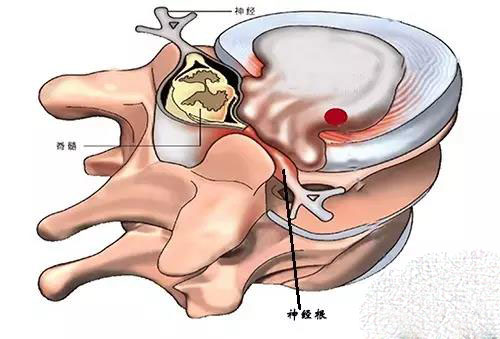 左上臂疼痛预示三种病,左上臂疼痛位置图详解