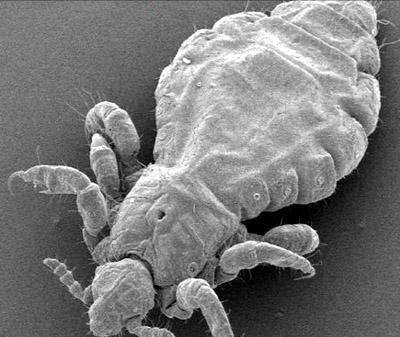 同样的环境下为何有白蚁和黑蚁,阴虱与虱子是同一种虫子吗