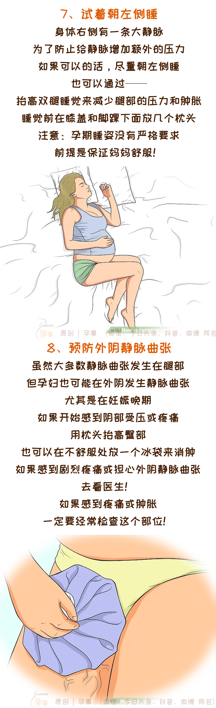 孕期外阴静脉曲张可以穿弹力袜吗,孕期得了静脉曲张产后可以恢复吗