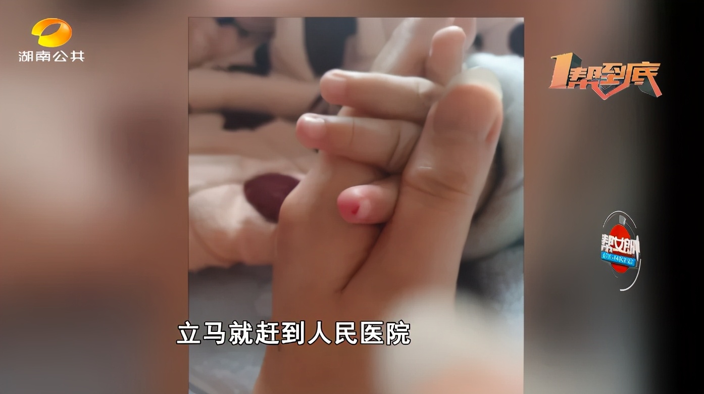 4个月宝宝手指剪流血了止不住血,四个月宝宝手指被剪出血