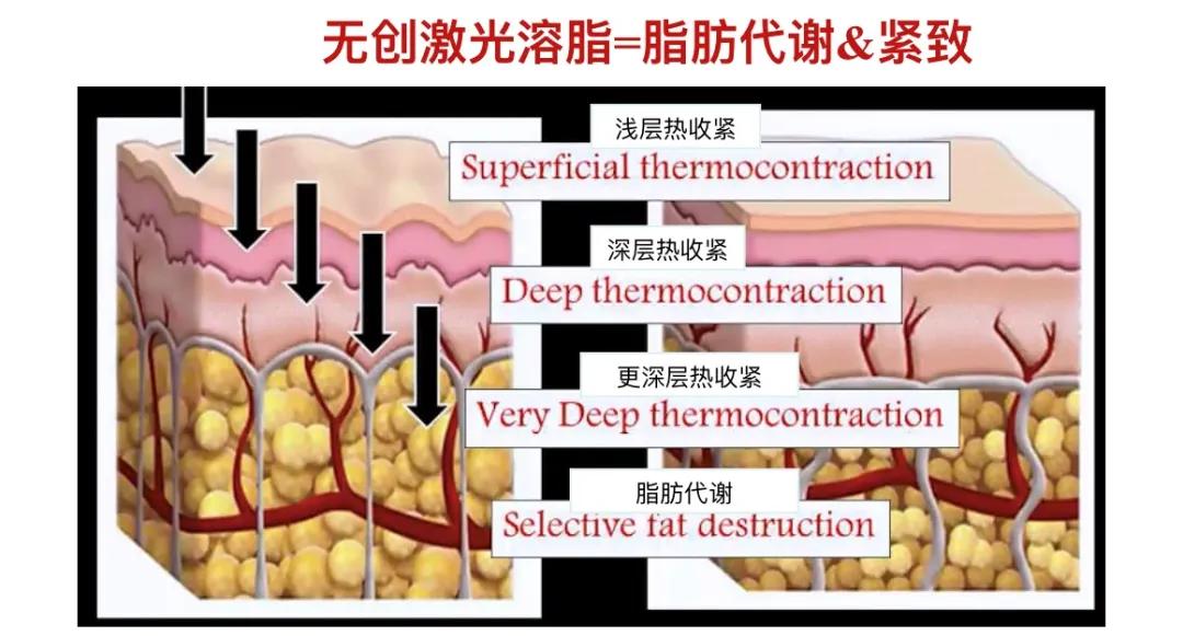 暑期变美变瘦好物推荐,暑假教你如何变美