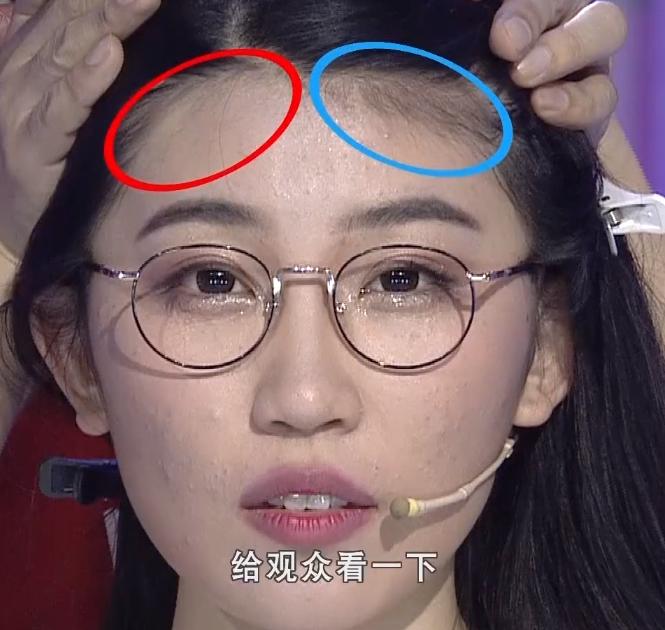 额头窄梳什么样的发型好看,额头扁平低矮