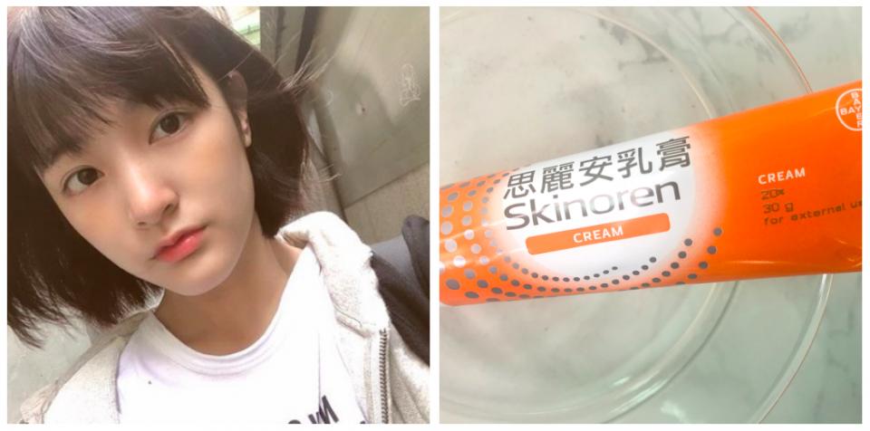 女明星专用祛痘膏,女明星祛痘药膏