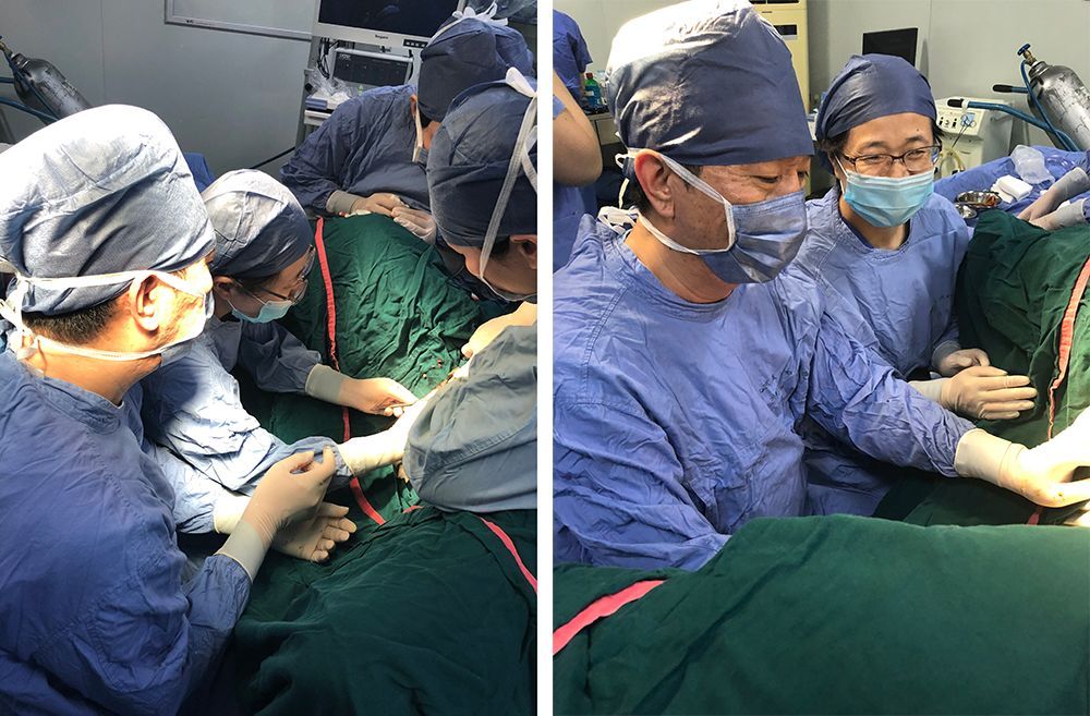 先天性肾上腺素组织增生症,肾上腺皮质增生羟化酶缺陷症