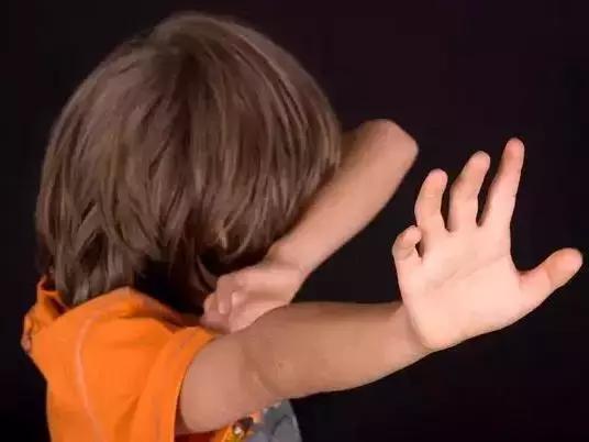 牙齿矫正别轻易拔牙,牙齿矫正要先磨牙吗