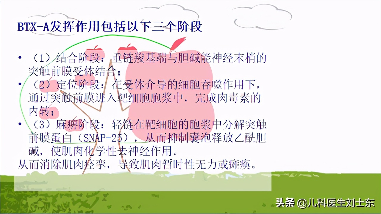 肉毒素治疗脑瘫患儿成功案例,肉毒素治疗脑瘫肌肉痉挛的效果