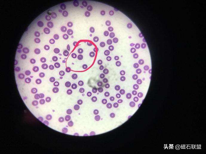 潜藏在蜱虫身上的“暗影”：犬巴贝斯虫的危害远比蜱虫要大得多