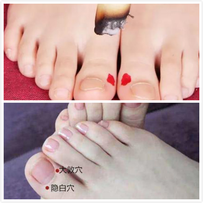 44岁戴着环月经突然不来怎么办,自从上了环后总是十多天怎么回事