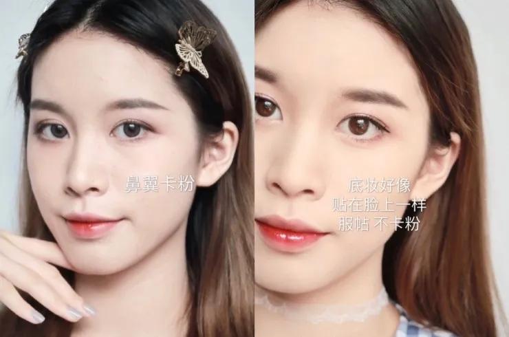 日本抗痘护肤品牌,日本护肤品淡斑美白排行榜