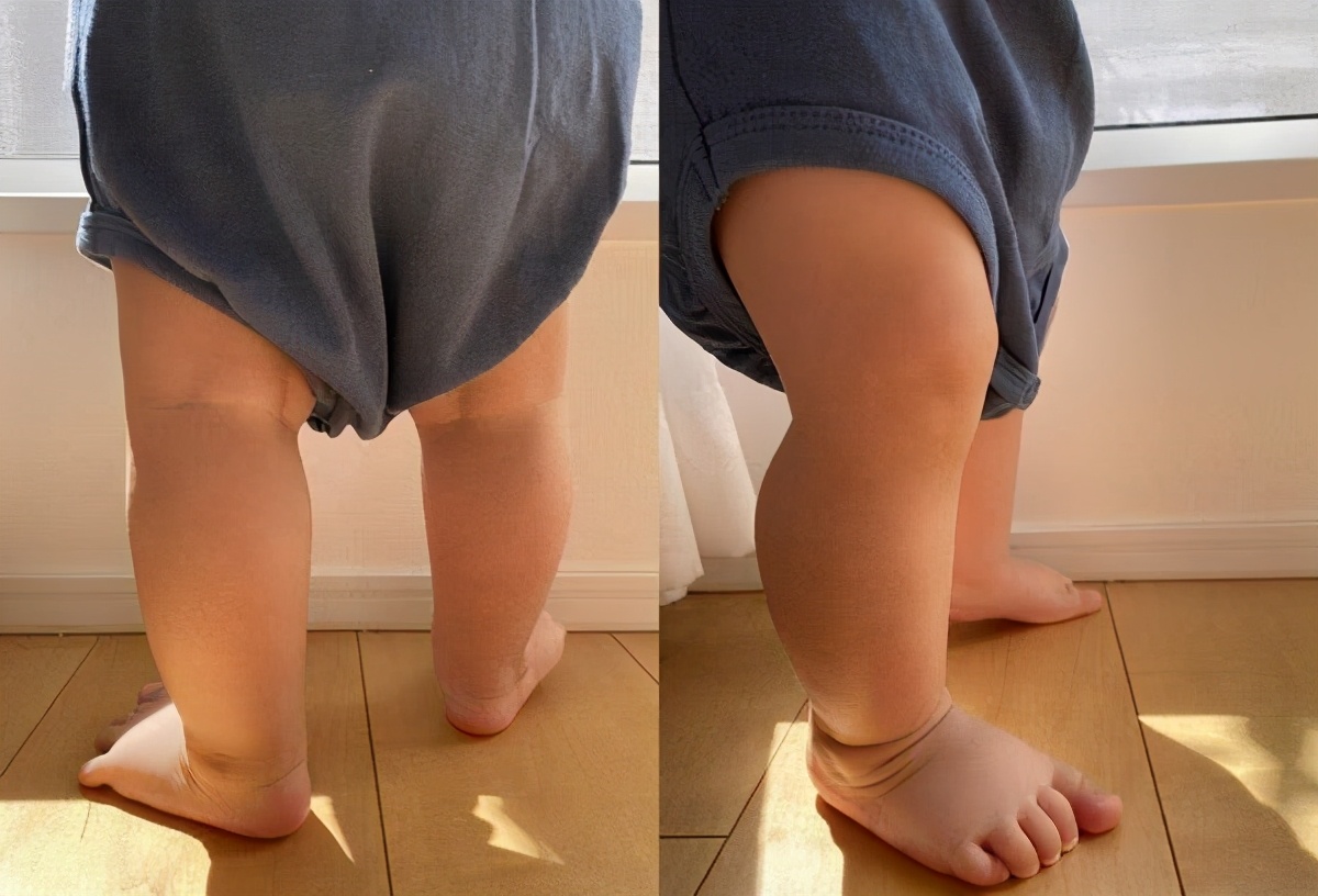 脚宽脚胖不好买鞋的就选这款鞋,脚宽脚胖凉鞋不臭脚