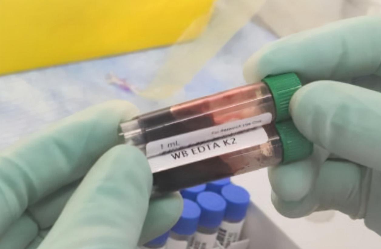 海关截获4米眼镜蛇活体,墨脱眼镜王蛇被咬一口有多毒