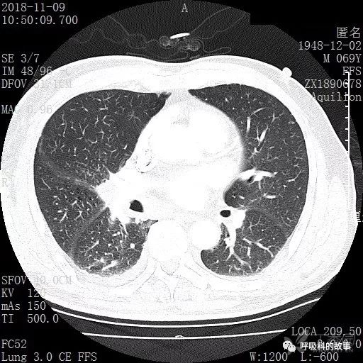 怎么应用统计学做调查,统计学方法可以解决的主要问题