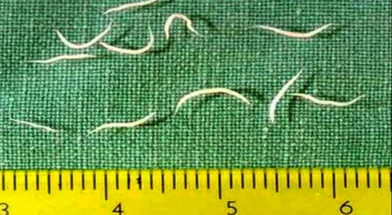 现在小学生要打虫吗,孩子打虫的季节