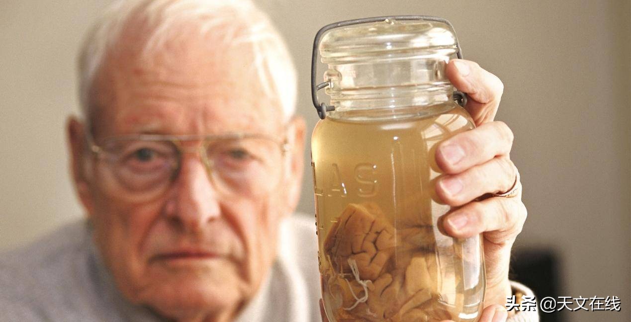 爱因斯坦大脑与常人一样说明什么,爱因斯坦的大脑和正常人的对比