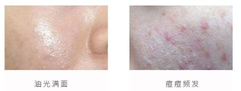 总算为国货争了口气，98.21%除螨率的洗面奶，张馨予也爱用