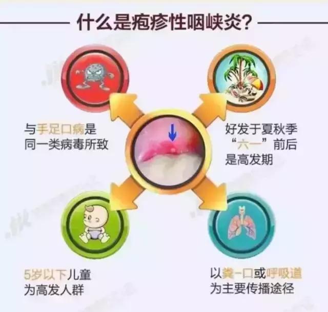 小儿疱疹性咽峡炎怎么治疗好得快,宝宝疱疹性咽峡炎怎么快速退烧