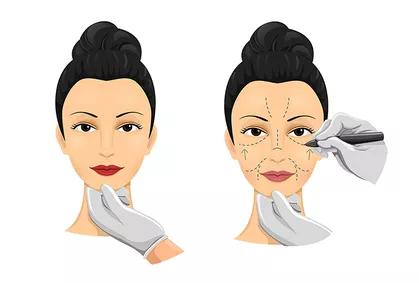 一样都是皱纹，打针和手术到底怎么选？|北京大学张宗学