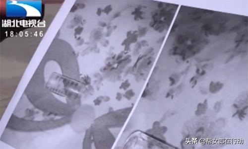 孕妇打保胎针后皮下感染怎么办,保胎针打了还流血怎么办