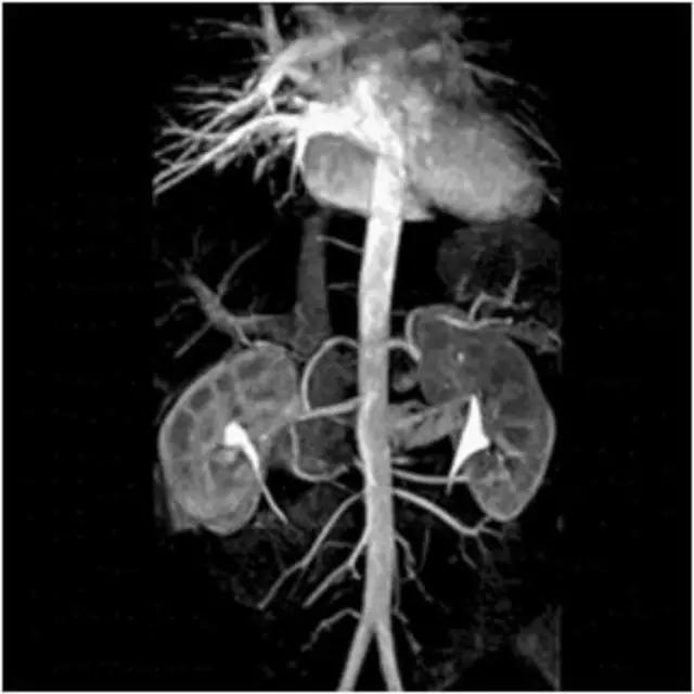 mri临床医师必读电子书,临床医生如何读mri