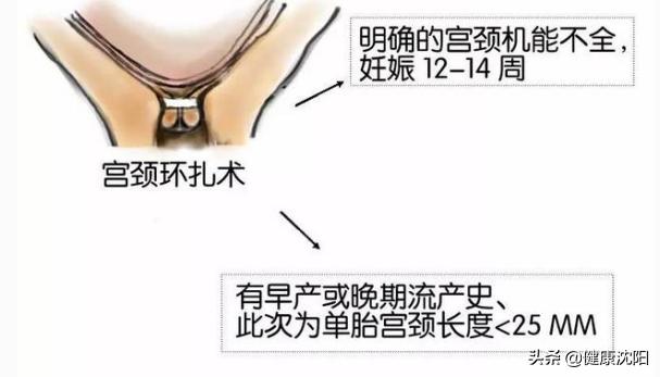 健康科普堂孕产妇应该怎么做,健康科普孕妈