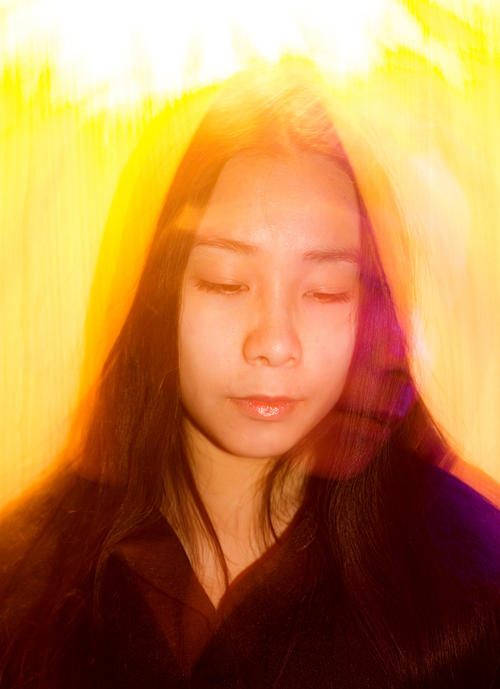 发作性嗜睡强食综合征患者,发作性嗜睡强食综合征的临床症状