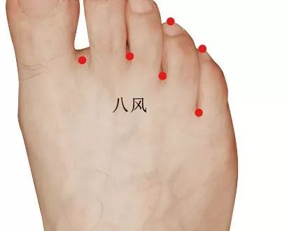 分期针刺治疗脑卒中后肢体功能障碍