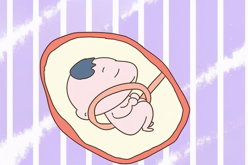 脐带绕颈三圈顺产的概率,臀位脐绕颈二周可以顺产吗