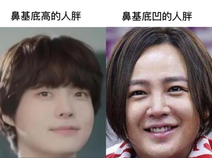 贵族手术的好处,鼻基底手术失败凹陷怎么改善