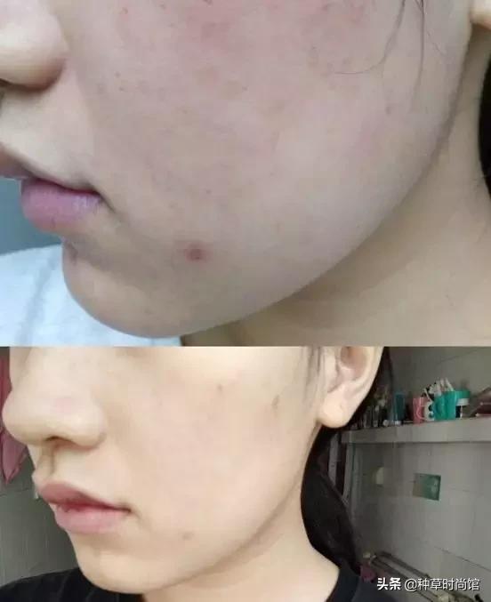 脸色暗黄干皮怎么变白最快方法,暗黄皮用什么护肤品变白