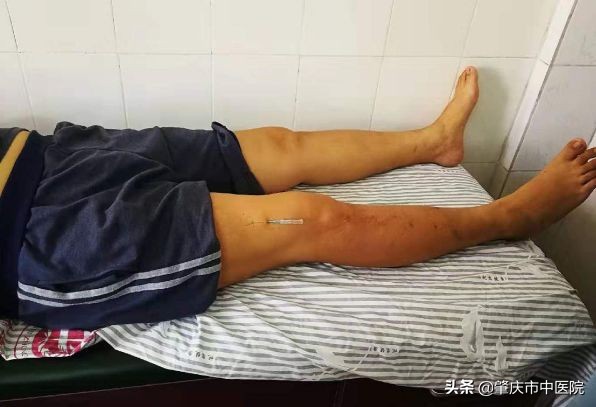 膝盖疼痛找中医骨伤科对吗,膝盖痛但是医生说没关系怎么办