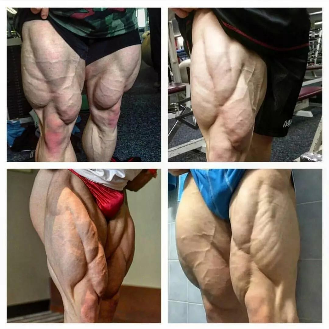 改善腿型的腿部运动,腿部拉伸矫正xo型腿