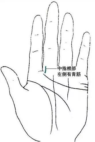 脑血栓刮这条“青筋”可防治，赶快告诉爸妈