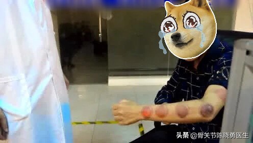 如何尽早摆脱网球肘的困扰,告别网球肘小妙招