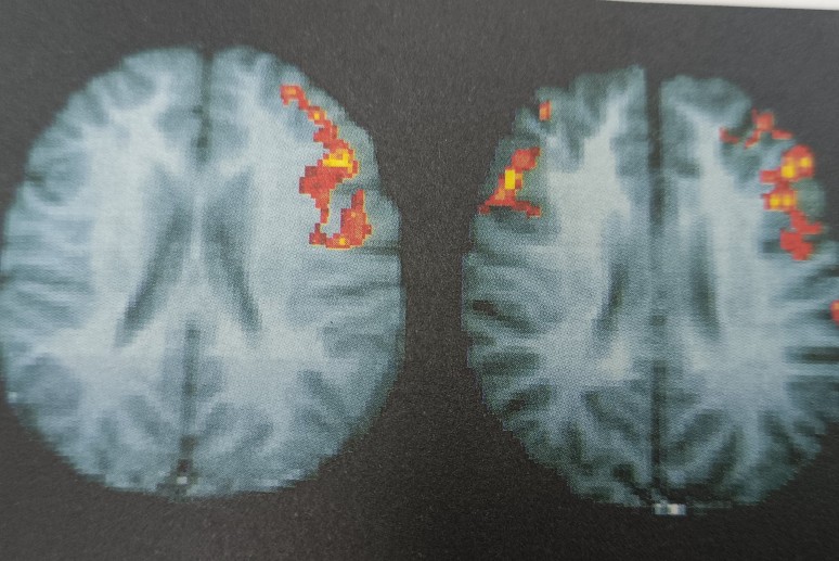 如何开发自己的右脑潜力,右脑人如何培养右脑