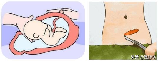 福祸相依荣辱与共共享喜怒哀乐,福祸相依双胞胎后续