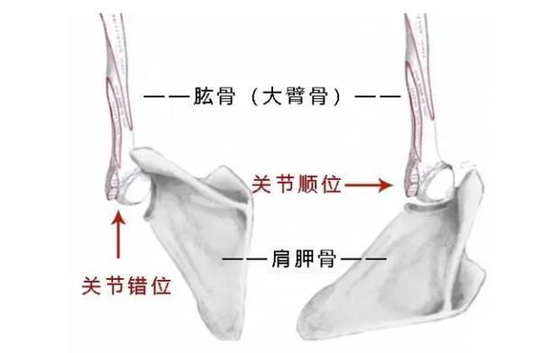 练瑜伽总是拱背怎么回事,练瑜伽耸肩缩脖怎么办