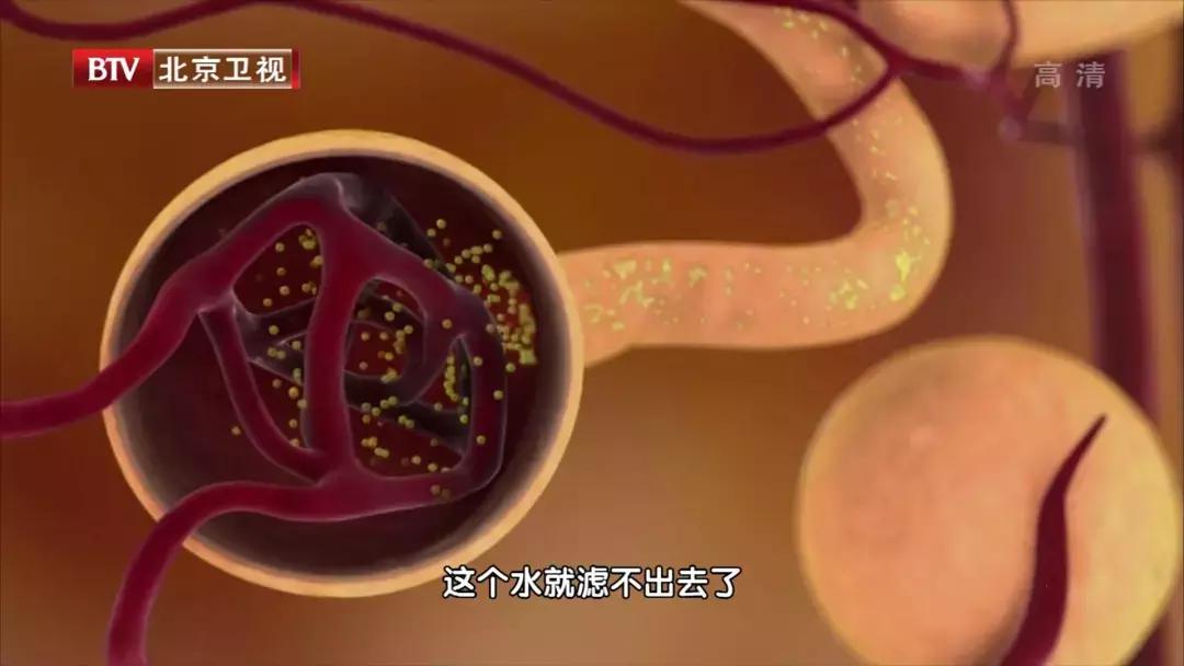 如何从尿液常规判断肾的健康状况,身体出现这几个症状时要警惕肾