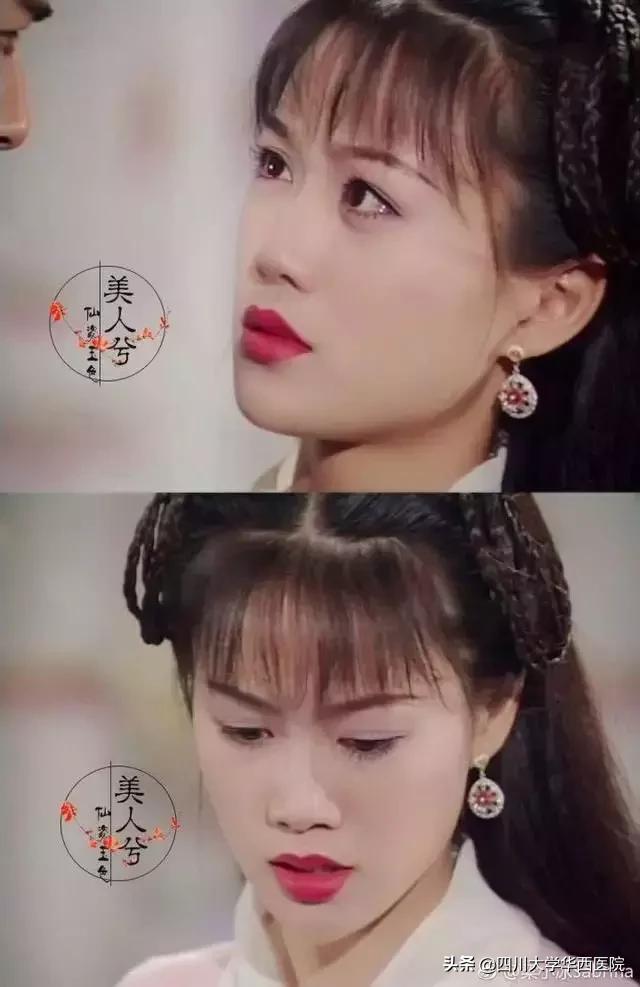 鼻子太翘怎么整形,鼻子太尖整形修复最佳方法