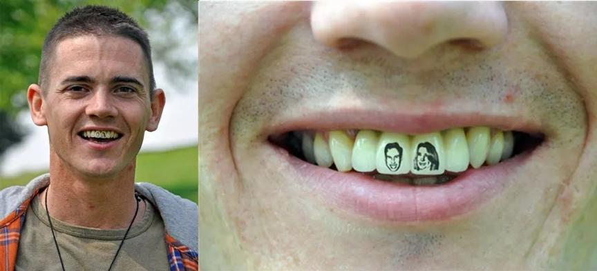 全球流行纹身,牙齿纹身图