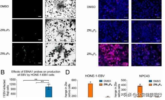 鼻咽癌特效新药,精准治疗鼻咽癌澳大研究取得突破