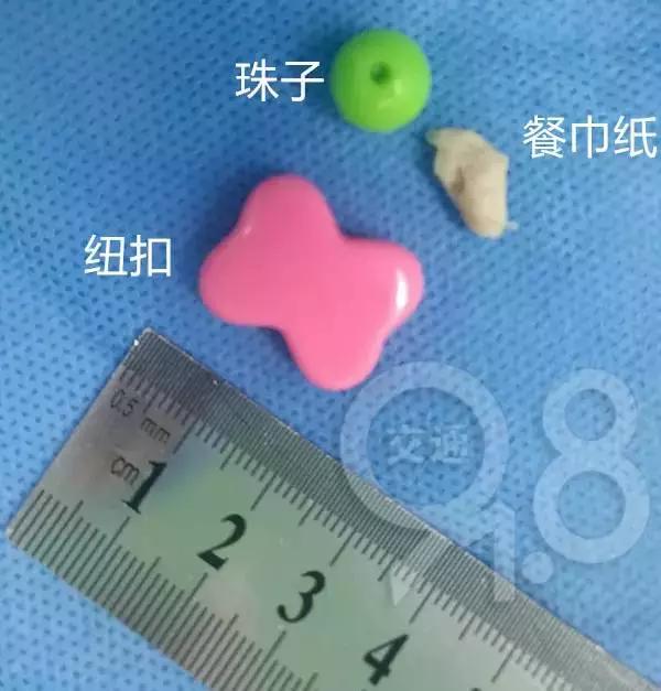 1岁女孩得怪病,1岁女孩患怪病