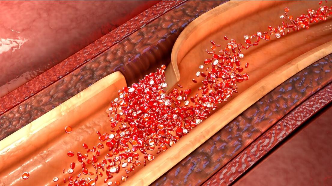 有高血压胸口几秒刺痛,如果你有高血压