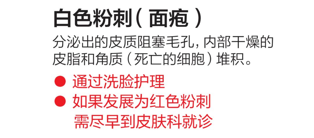 刘雨昕面膜特效,刘雨昕不遮痘