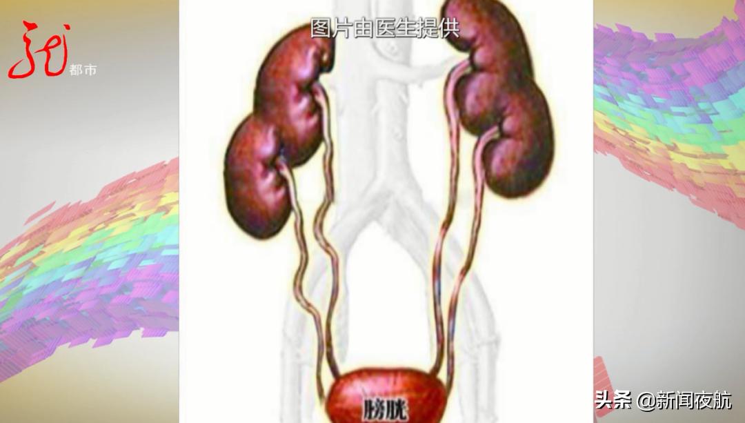 5岁女孩整天穿着尿不湿，每天总是尿不完，检查发现竟然长了三个肾