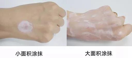 藿香正气水祛痱子快速消除,去痱子用风油精还是藿香正气液