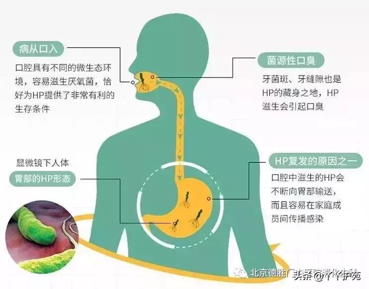 慢性胃炎的主要护理措施,慢性胃炎治疗与注意事项